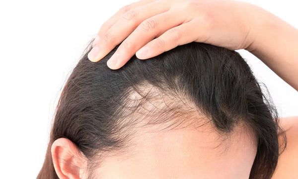 Premenopausal Hair Loss: Causes and Effective Solutions