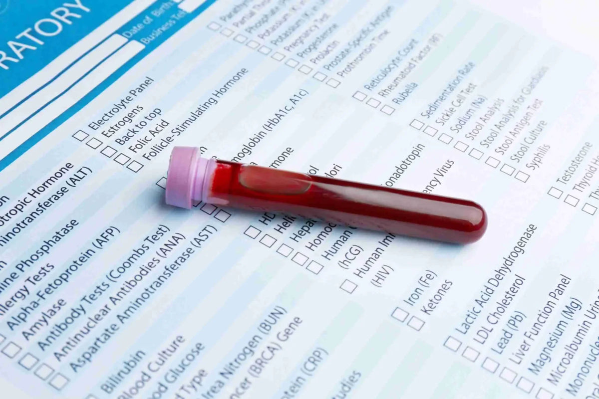 Menopause Blood Test Results: How to Read and Understand Them