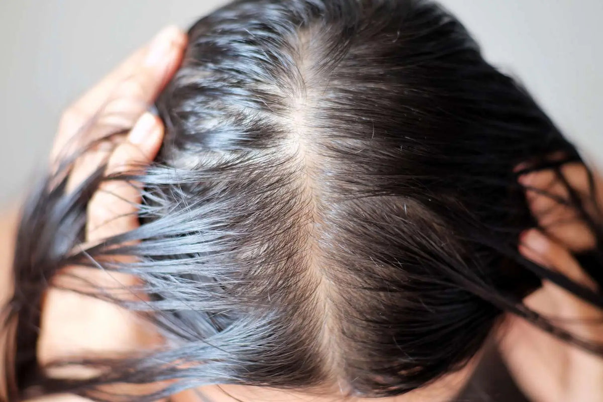 Perimenopause and Thinning Hair: Causes and Treatments