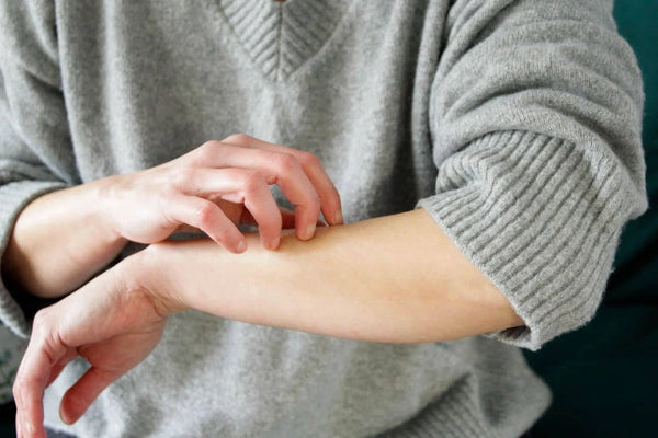 Menopause and Itching: Causes, Symptoms, and Relief