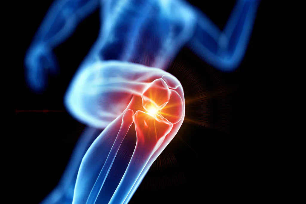 Best Joint Health Supplements: What Works and What to Know