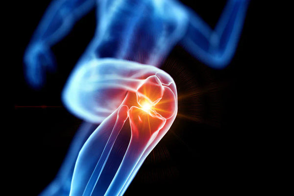 Best Joint Health Supplements: What Works and What to Know